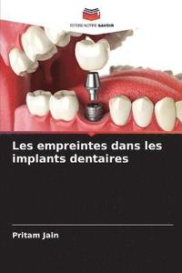 bokomslag Les empreintes dans les implants dentaires