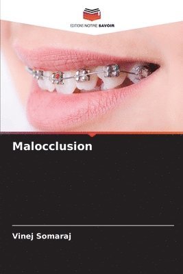 bokomslag Malocclusion