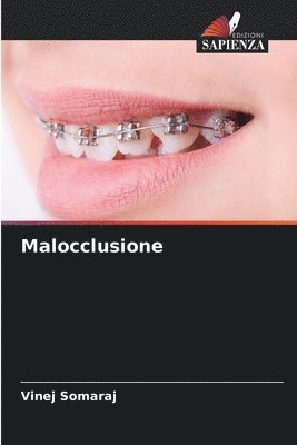 bokomslag Malocclusione