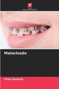 bokomslag Maloclusão