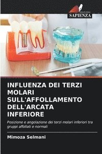 bokomslag Influenza Dei Terzi Molari Sull'affollamento Dell'arcata Inferiore