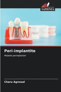 bokomslag Peri-implantite