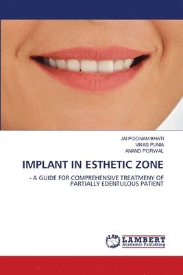 Implant in Esthetic Zone 1