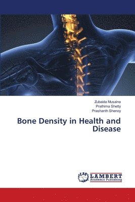 Bone Density in Health and Disease 1