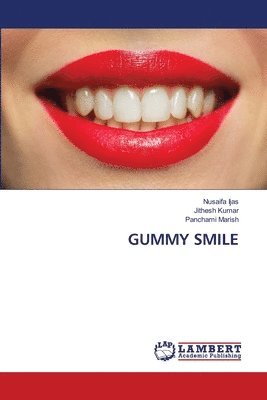 Gummy Smile 1