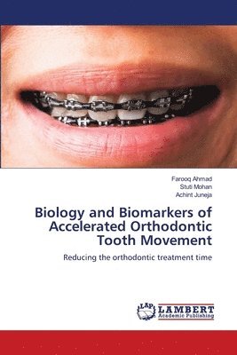 bokomslag Biology and Biomarkers of Accelerated Orthodontic Tooth Movement