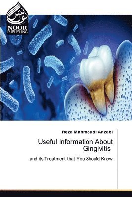 bokomslag Useful Information About Gingivitis