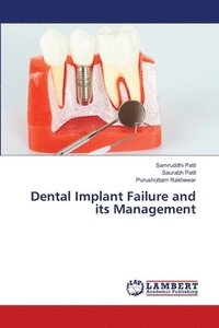 bokomslag Dental Implant Failure and its Management