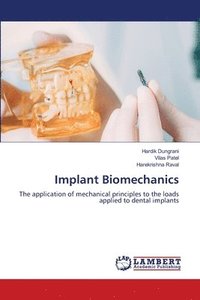 bokomslag Implant Biomechanics