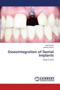 bokomslag Osseointegration of Dental Implants
