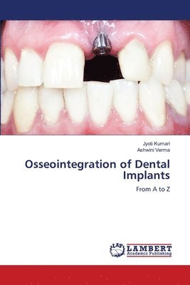 Osseointegration of Dental Implants 1