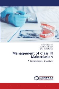 bokomslag Management of Class III Malocclusion