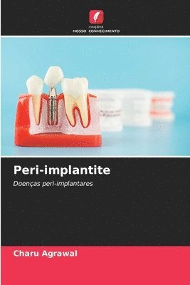 Peri-implantite 1