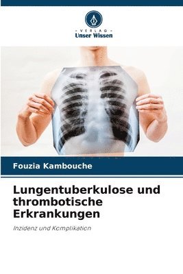 Lungentuberkulose und thrombotische Erkrankungen 1