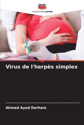 Virus de l'herps simplex 1