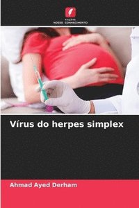 bokomslag Vrus do herpes simplex