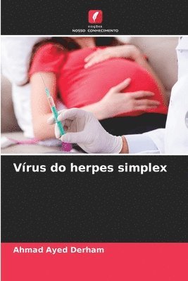 Vrus do herpes simplex 1