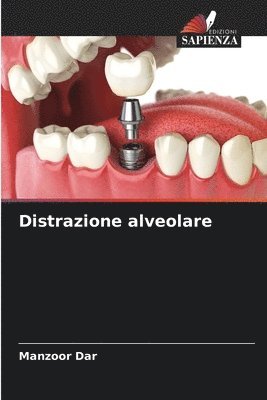 Distrazione alveolare 1