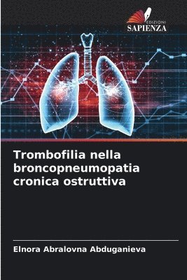 Trombofilia nella broncopneumopatia cronica ostruttiva 1