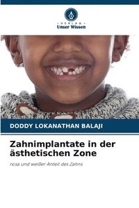 bokomslag Zahnimplantate in der asthetischen Zone