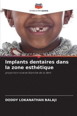 bokomslag Implants dentaires dans la zone esthetique