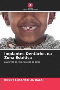 bokomslag Implantes Dentrios na Zona Esttica