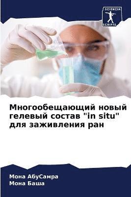 Мона АбуСамра, Мона Баша, &#1040;&#1073;&#1091;&#1057;&#1072;&#108, &#1052;&#1 &#1041;&#1072;&#1096;&#1072;, ¿¿¿¿ ¿¿¿¿¿¿¿¿, ¿¿¿¿ ¿¿¿¿ - Многообещающий новый гелевый состав "in situ" дл&#11, Häftad