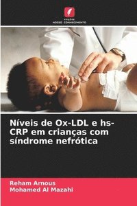 bokomslag Nveis de Ox-LDL e hs-CRP em crianas com sndrome nefrtica