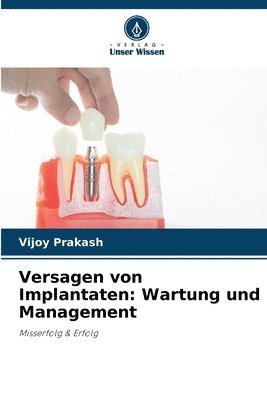 Versagen von Implantaten 1