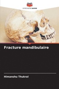 bokomslag Fracture mandibulaire