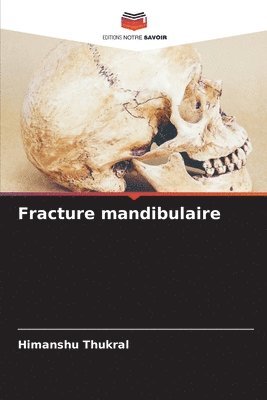 Fracture mandibulaire 1