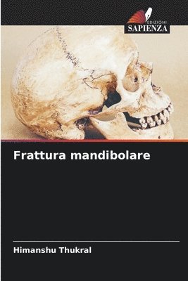 Frattura mandibolare 1