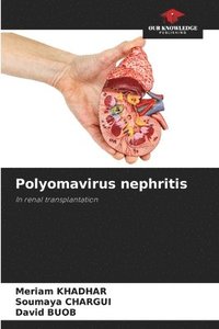 bokomslag Polyomavirus nephritis