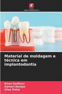 bokomslag Material de moldagem e tcnica em implantodontia