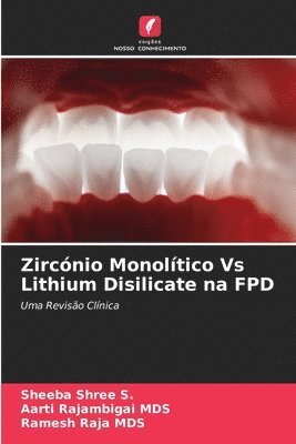 bokomslag Zircnio Monoltico Vs Lithium Disilicate na FPD