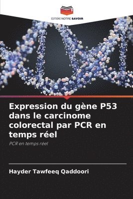 Expression du gne P53 dans le carcinome colorectal par PCR en temps rel 1