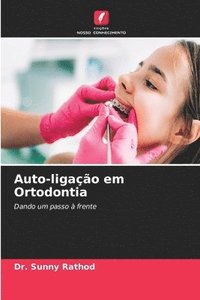 bokomslag Auto-ligao em Ortodontia