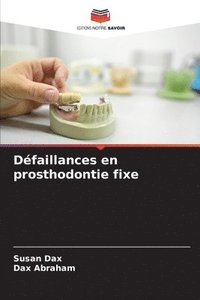 bokomslag Dfaillances en prosthodontie fixe