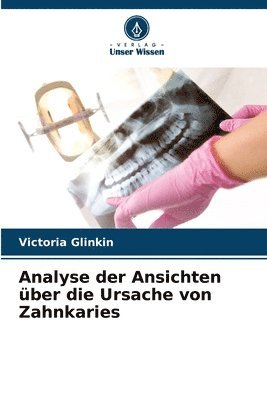 Analyse der Ansichten ber die Ursache von Zahnkaries 1