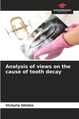 Analysis of views on the cause of tooth decay 1