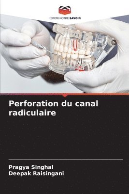Perforation du canal radiculaire 1