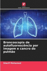 bokomslag Broncoscopia de autofluorescncia por imagem e cancro do pulmo