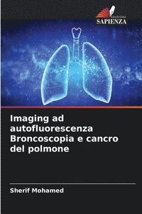 bokomslag Imaging ad autofluorescenza Broncoscopia e cancro del polmone