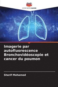 bokomslag Imagerie par autofluorescence Bronchovideoscopie et cancer du poumon