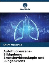 bokomslag Autofluoreszenz-Bildgebung Bronchovideoskopie und Lungenkrebs