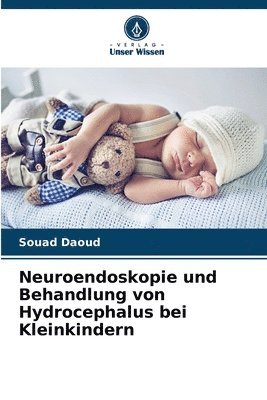 Neuroendoskopie und Behandlung von Hydrocephalus bei Kleinkindern 1