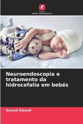 Neuroendoscopia e tratamento da hidrocefalia em bebs 1