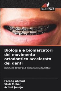 bokomslag Biologia e biomarcatori del movimento ortodontico accelerato dei denti