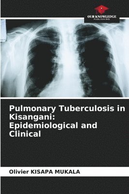 bokomslag Pulmonary Tuberculosis in Kisangani