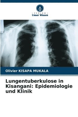 Lungentuberkulose in Kisangani 1